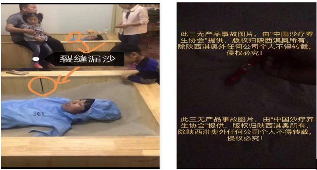 沙療的真假分辨及價格、優劣對比(圖77)